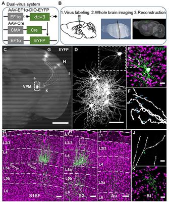 Cross-Streams Through the Ventral Posteromedial Thalamic Nucleus to Convey Vibrissal Information